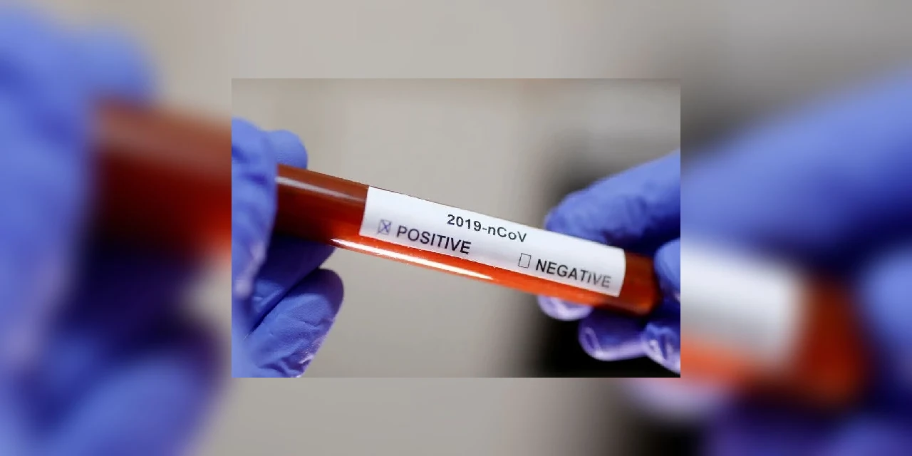 Segundo caso de coronavírus no Rio de Janeiro é de uma mulher que viajou para a Itália