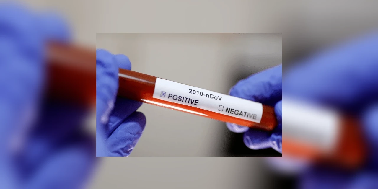 Coronavírus: sobe para 25 o número de casos confirmados no Brasil