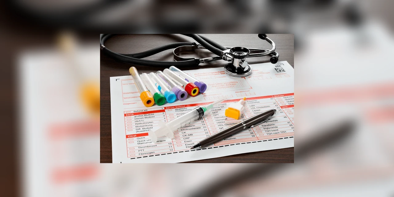 Sem kits para exames, laboratórios da rede privada de PG deixam de fazer o teste de Coronavírus