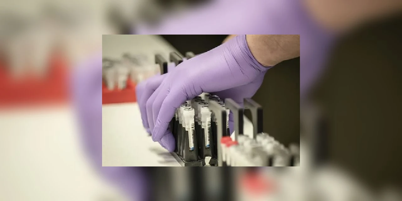 Tibagi monitora três pacientes com suspeita de COVID-19