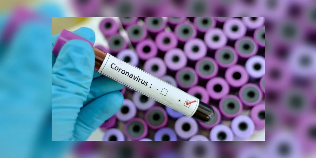 Guarapuava tem primeiro caso confirmado de coronavírus