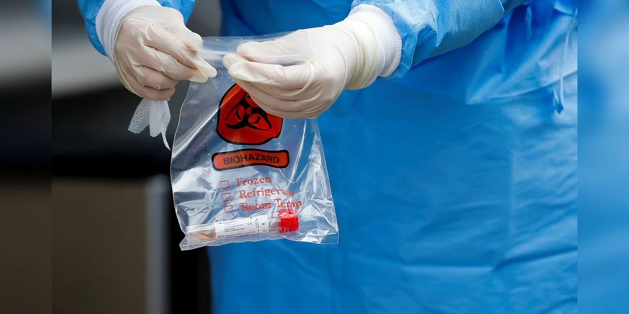 Cientistas descobrem como impedir coronavírus de entrar nas células