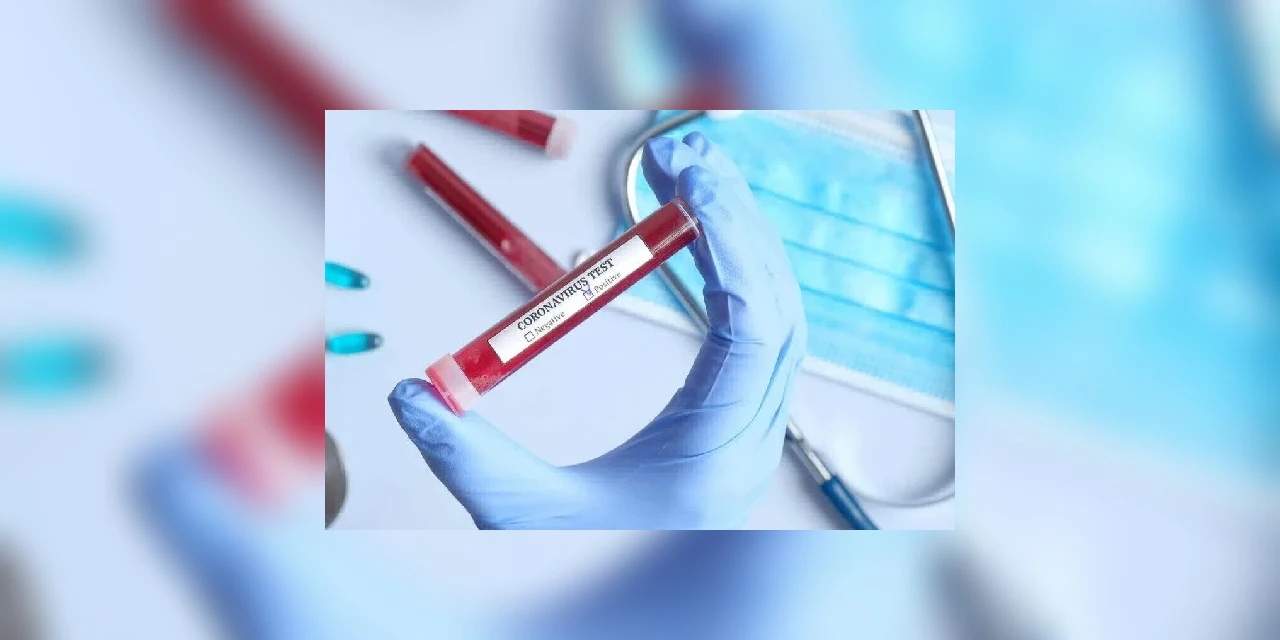 Coronavírus: Paraná registra 33 óbitos e 768 casos confirmados (13/04)