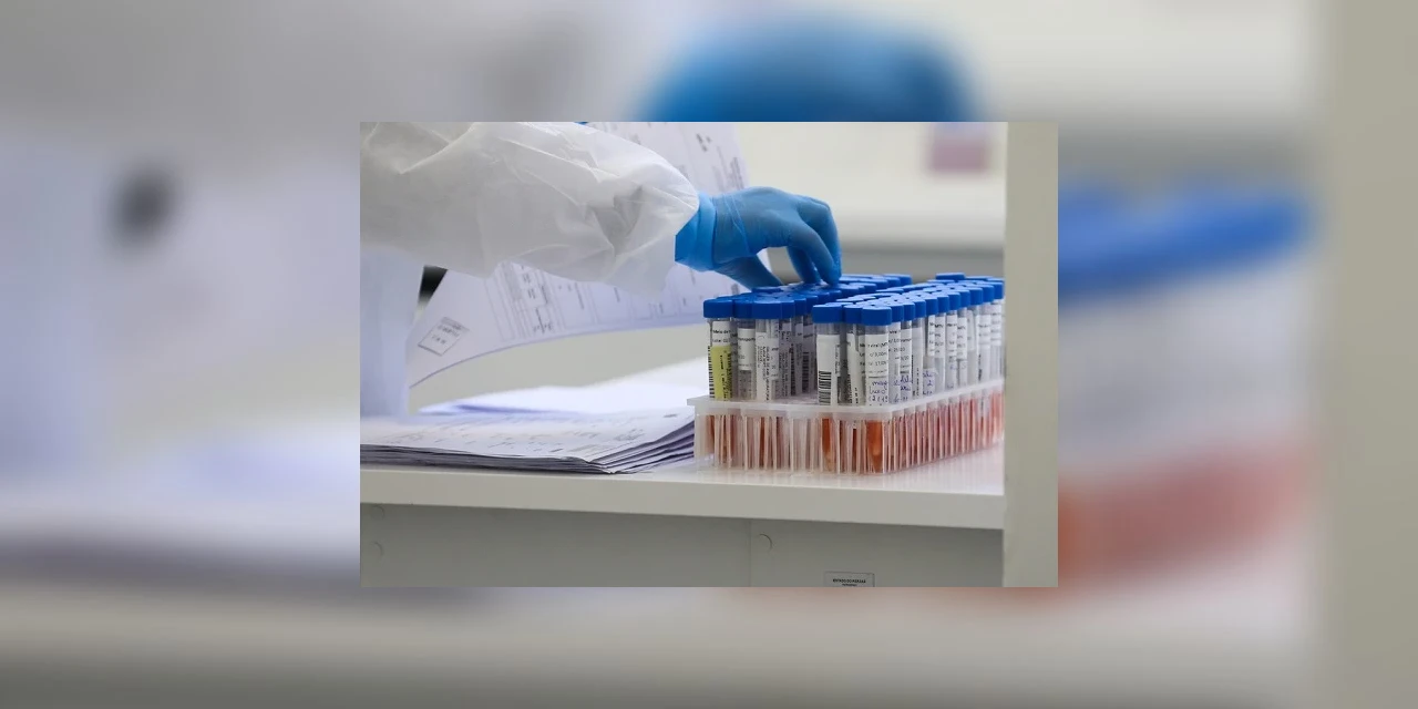 Instituto cria teste que detecta o coronavírus em um minuto