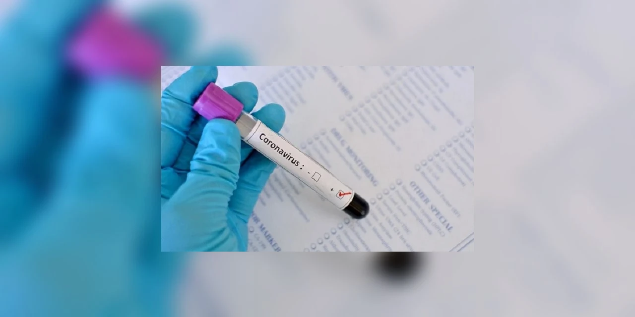 Aumenta em 830% a capacidade de testes diários da COVID-19 no Paraná
