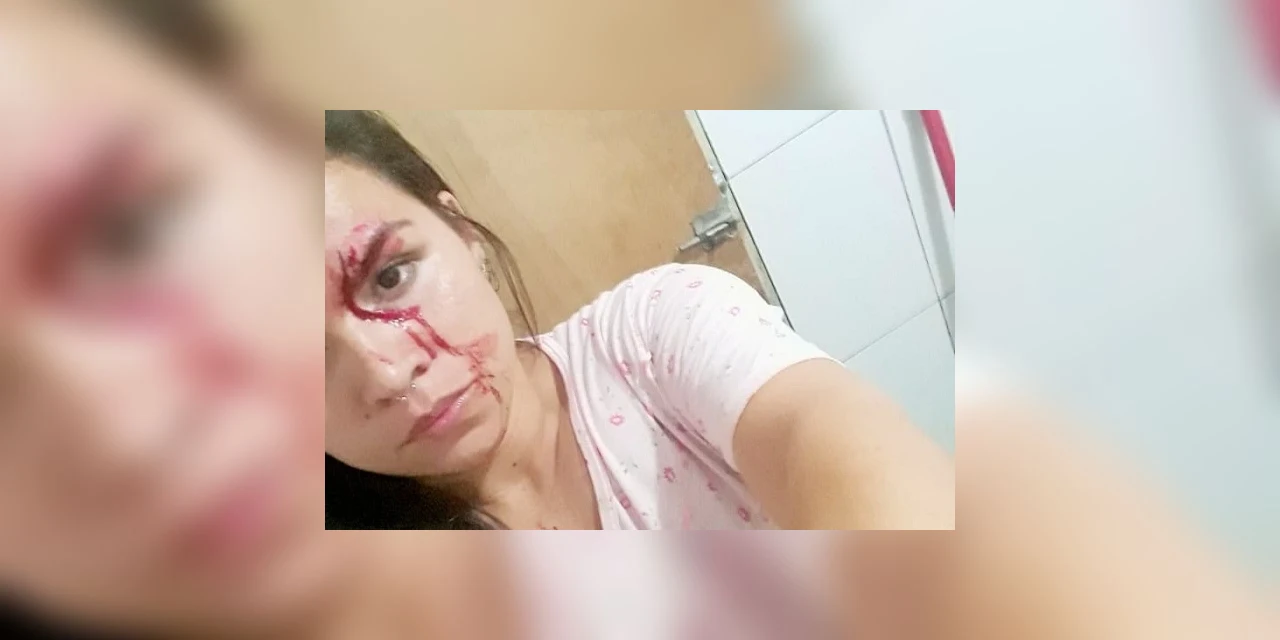 Mulher publica foto em redes sociais denunciando agressão de marido em PG