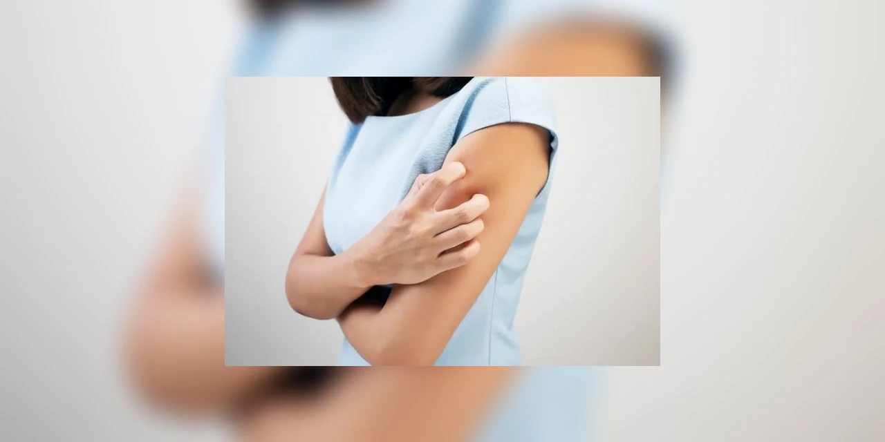 Coceiras, manchas e bolhas: estudo sugere novos sintomas do coronavírus