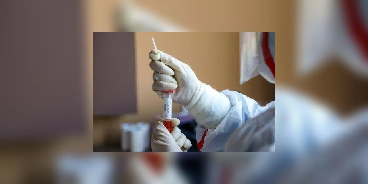 Covid-19: Mais de 300 casos monitorados têm a contaminação descartada em PG