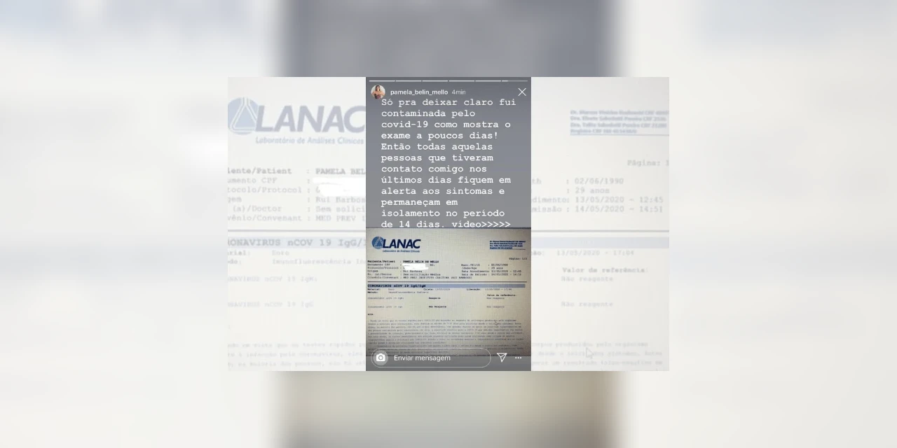 Após participar de festa com 150 pessoas em Prudentópolis, jovem revela ter testado positivo para Covid-19