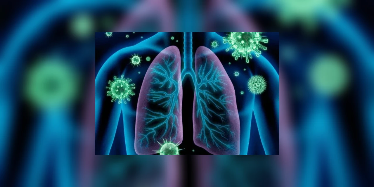 Número de mortes por Síndrome Respiratória Aguda Grave sobe 513% no PR