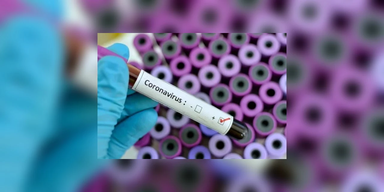 Tibagi confirma mais um caso de COVID-19 no município