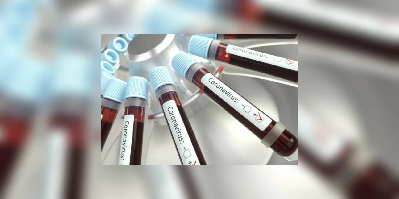 Campos Gerais registram 40 novos casos de Covid-19; taxa de ocupação dos leitos de UTI no HU é de 70%