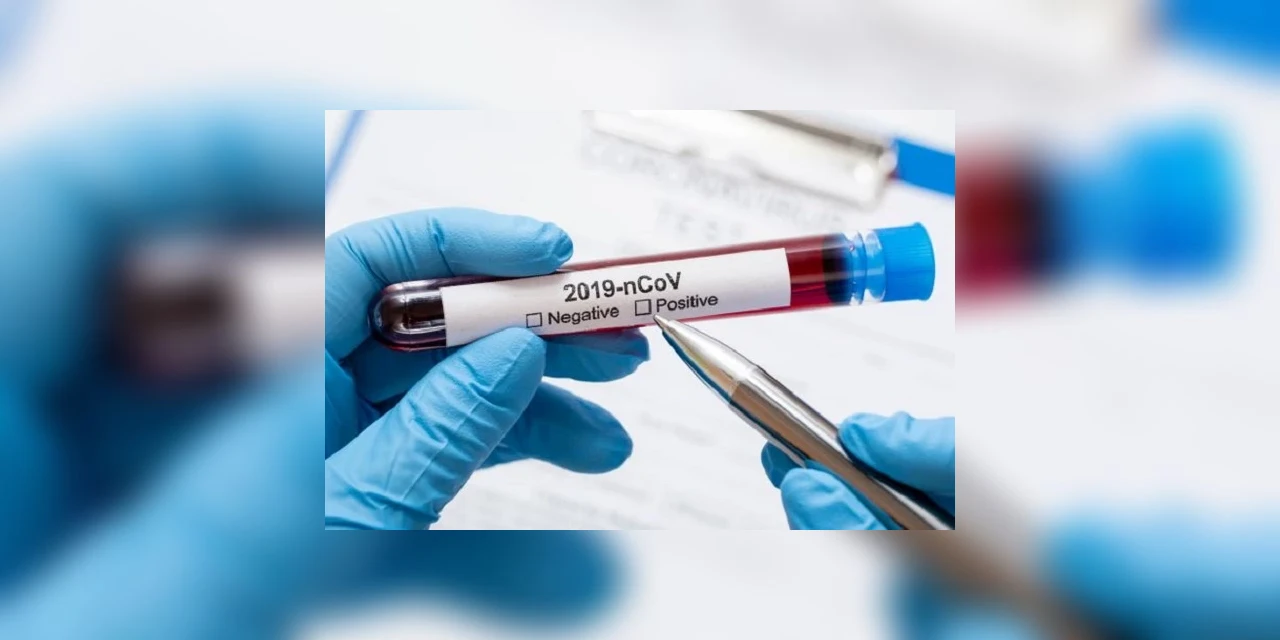 Prefeitura de Palmeira informa que todos os casos de não residentes na cidade estão recuperados da Covid-19