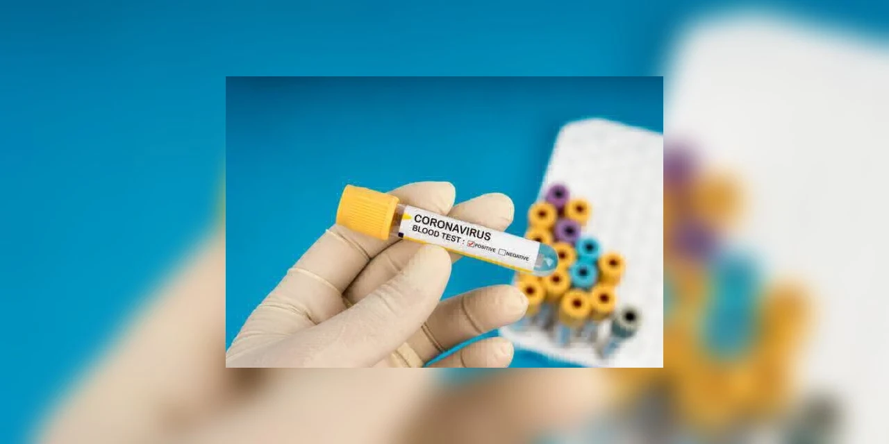 Sesa confirma 1.135 diagnósticos positivos e Paraná se aproxima de 20 mil casos de Covid-19