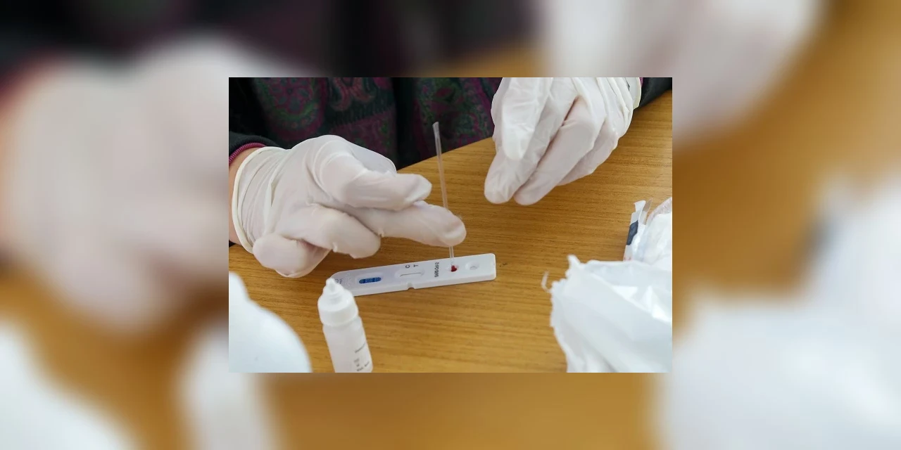 Testes para Covid-19 passam a ser procedimentos obrigatórios de planos de saúde