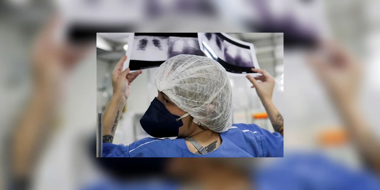 Três Universidades do Paraná desenvolvem apoio a diagnóstico de Covid-19 com raio-x