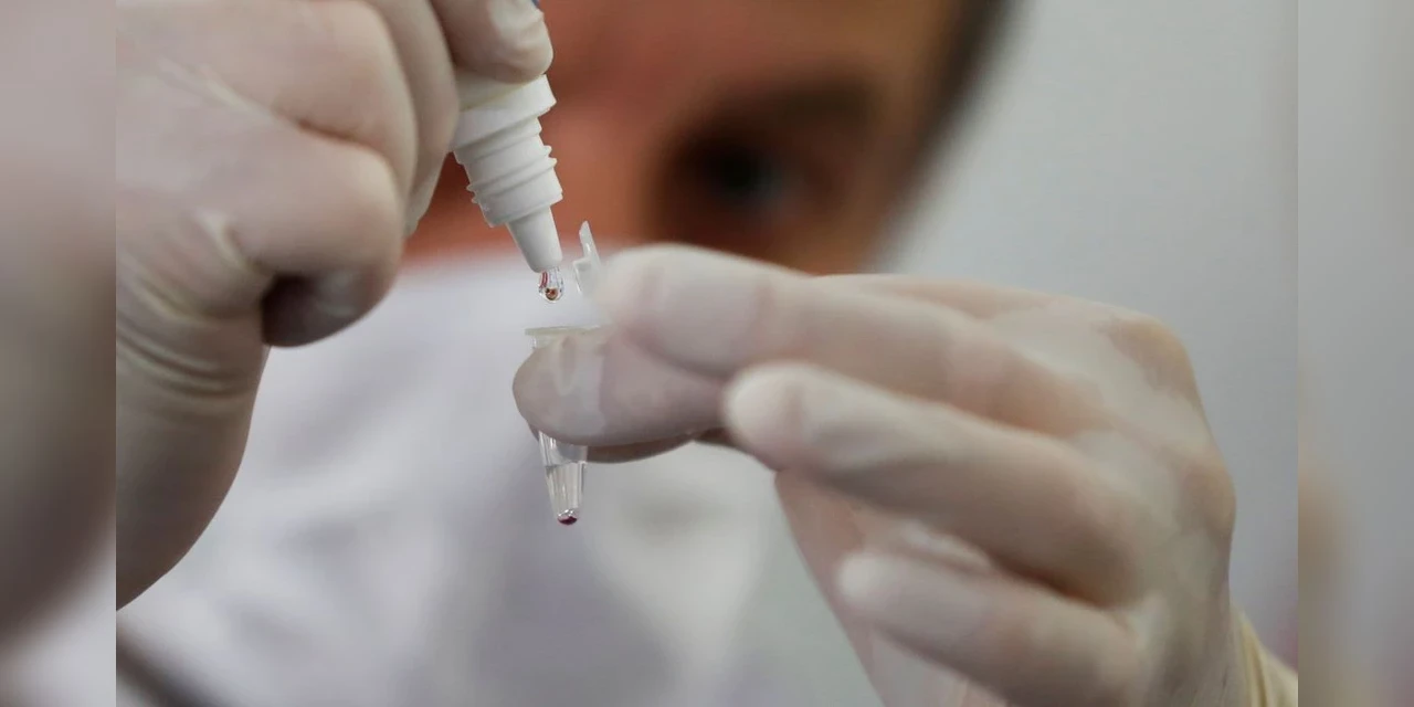 Teste de remédio de anticorpos contra covid-19 é aprovado na Coreia do Sul