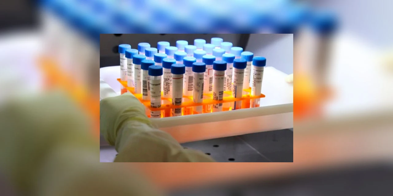 Governo brasileiro compra 100 milhões de doses da vacina de Oxford contra a COVID-19, afirma secretário de vigilância em Saúde