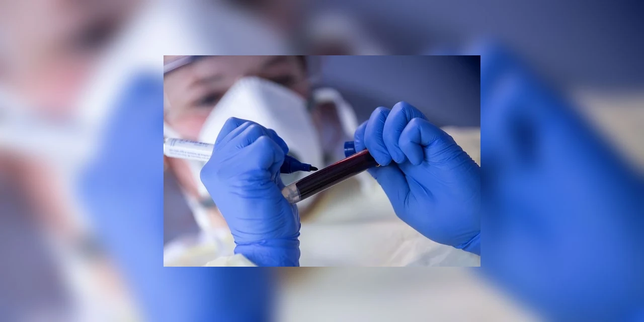 Paraná registra 93 mil casos de COVID-19 e mais de 2 mil mortes pela doença