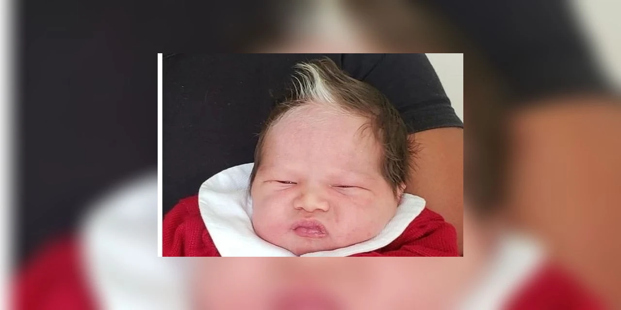 Bebê nasce com mecha de cabelo branco e viraliza nas redes