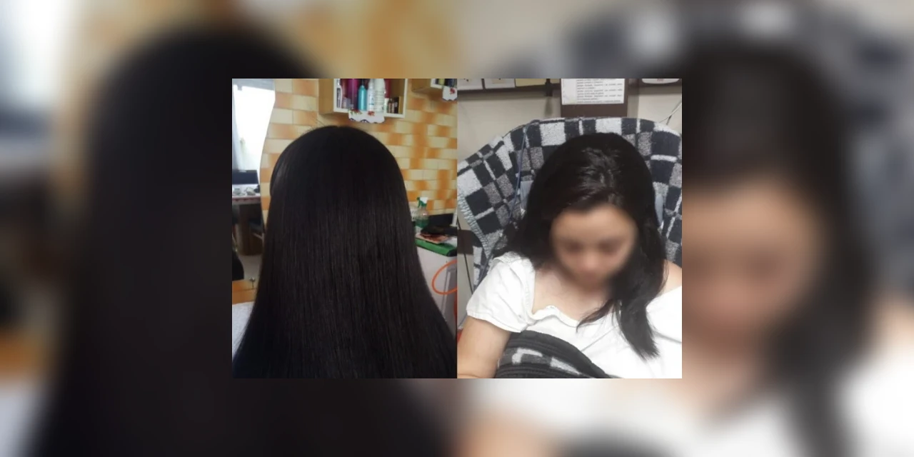 Jovem paranaense fica três dias na UTI após fazer escova progressiva no cabelo