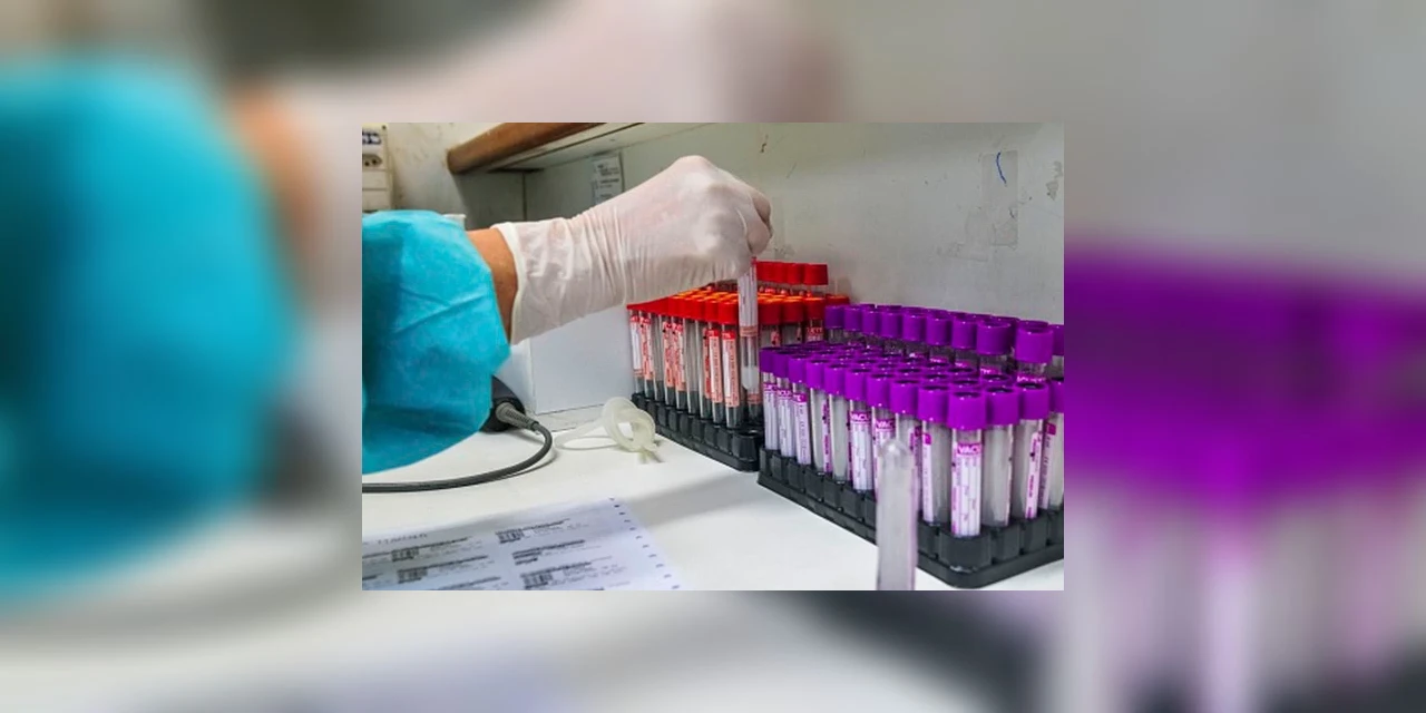 COVID-19: UFRJ desenvolve teste sorológico 20 vezes mais barato