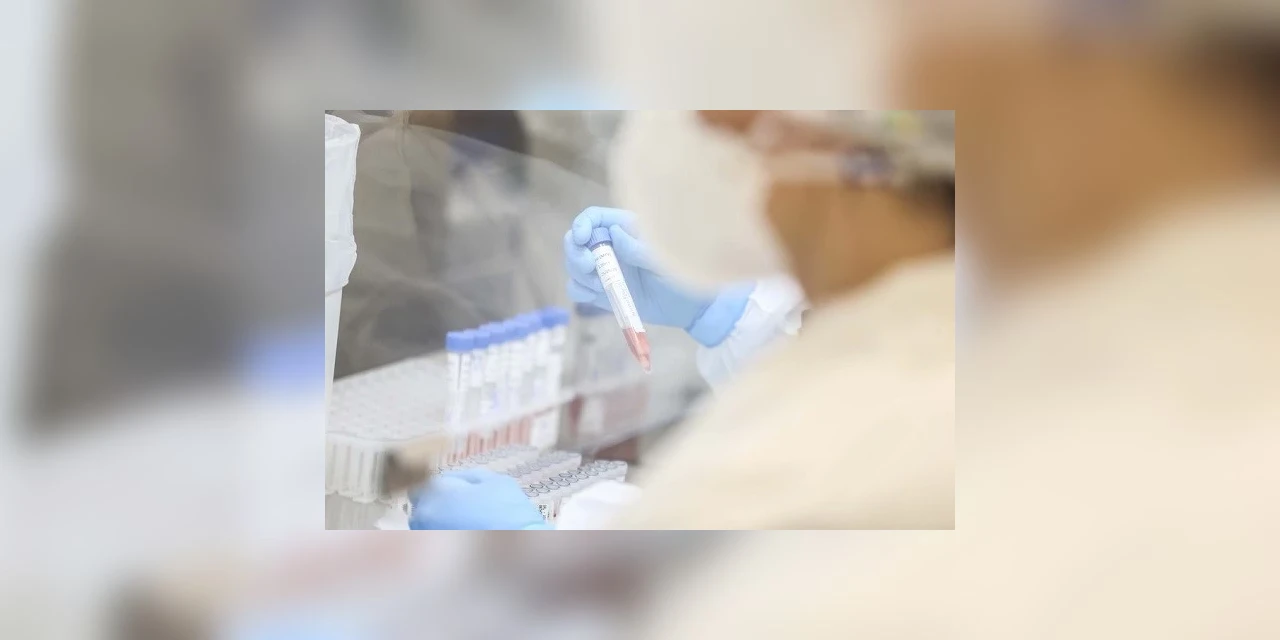 Paraná é o estado que mais realiza testes para detectar o coronavírus