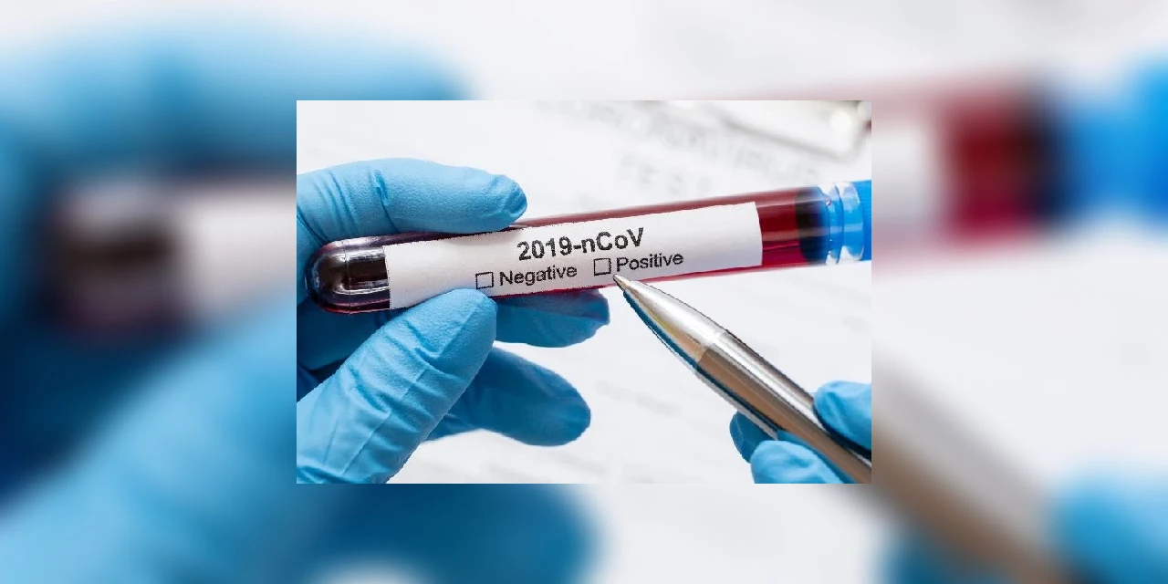 COVID-19: Paraná registra 1.066 novos casos e 45 óbitos nesta quarta-feira (9)