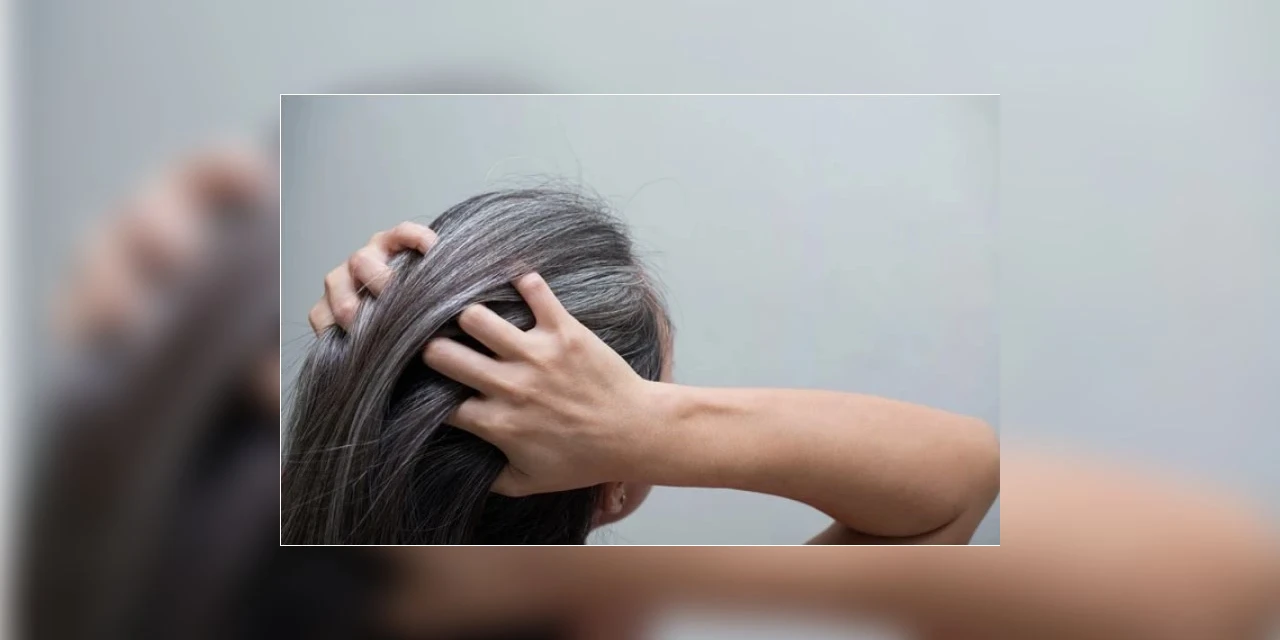 Artigo: Saiba como reverter o embranquecimento dos cabelos sem tintura