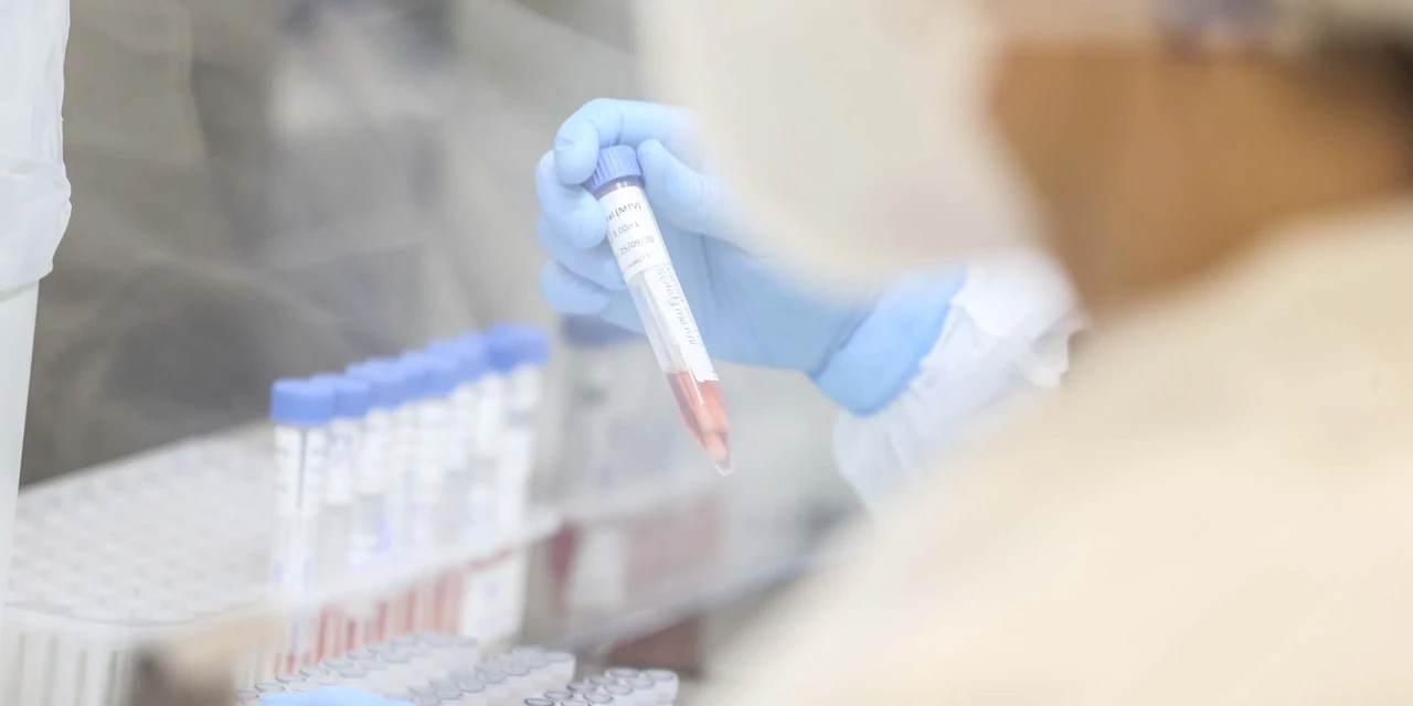 Paraná confirma cinco casos de infectados com a variante brasileira da Covid-19