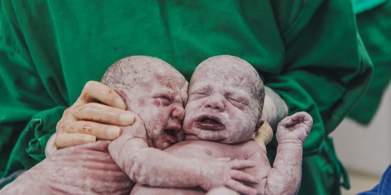 Gêmeas se abraçam após parto em SC e fotos emocionam; confira