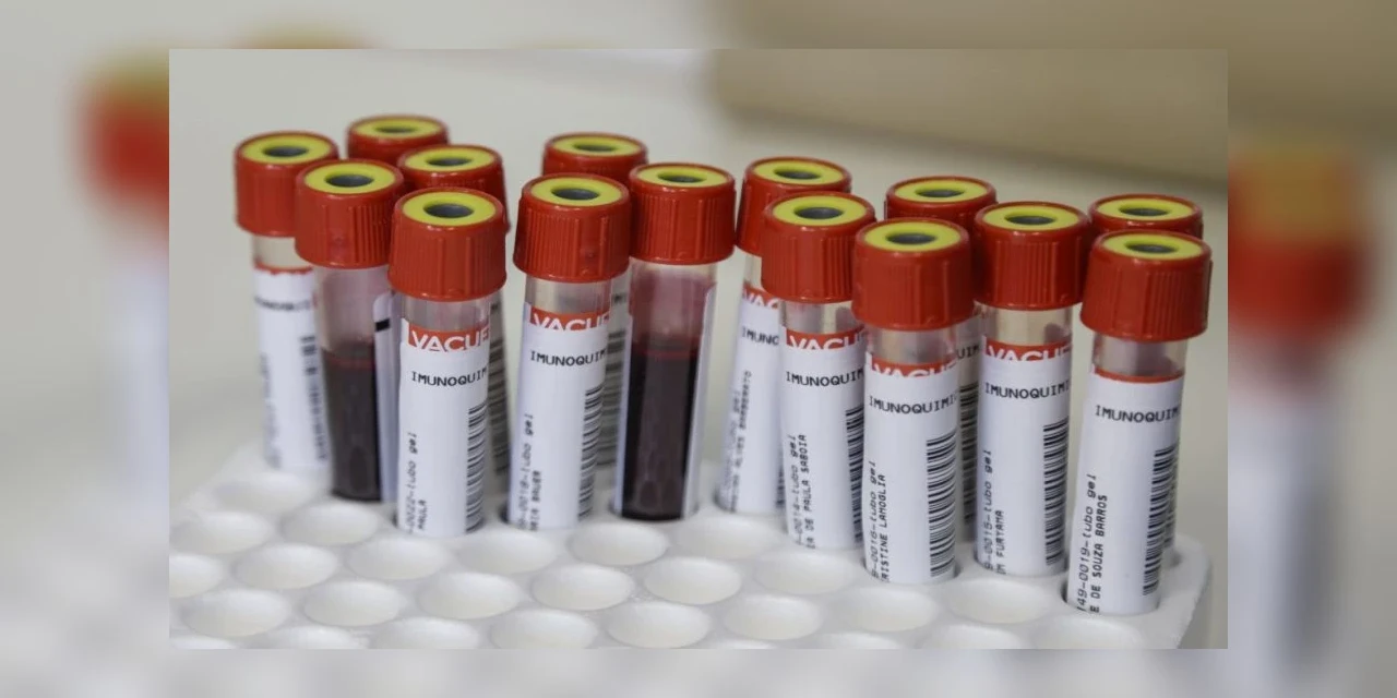 Nova cepa da COVID-19 é encontrada em 70% dos casos de maior carga viral no Paraná