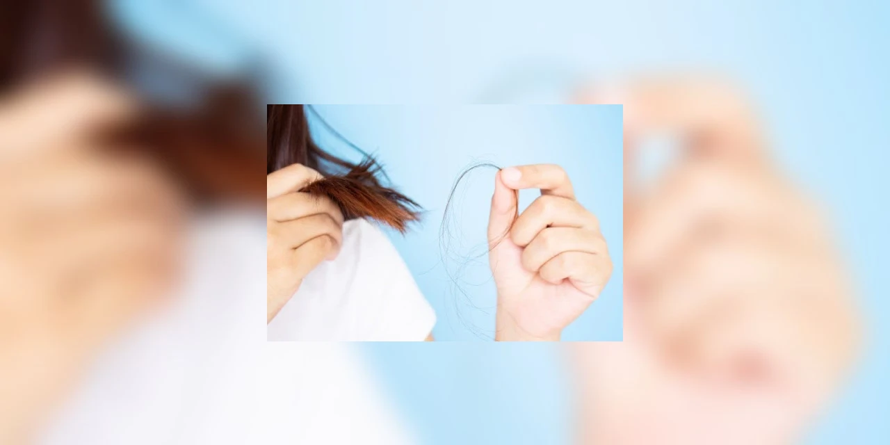 COVID-19 pode acarretar perda de cabelo reversível