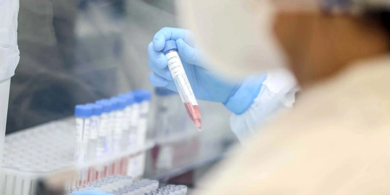 Paraná registra 8.112 novos casos e 286 mortes por COVID-19 nesta sexta-feira