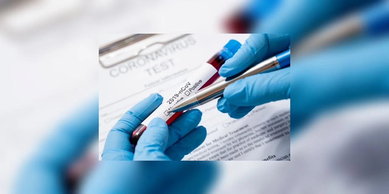 Paraná confirma mais 1.436 casos e 106 mortes por COVID-19