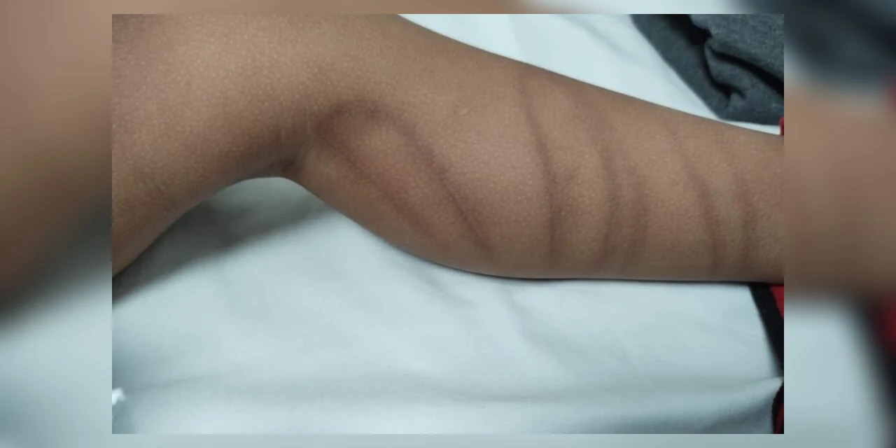 Criança de quatro anos é espancada pelo padrasto no Paraná