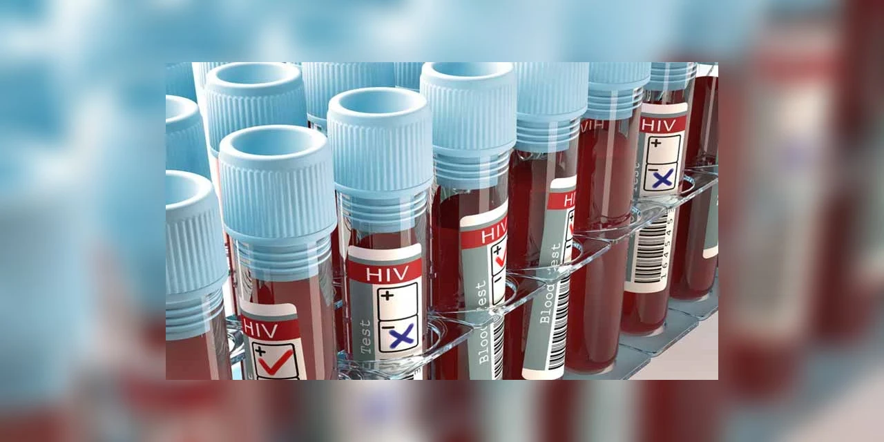 Laboratório é condenado a indenizar paciente por falso positivo de HIV