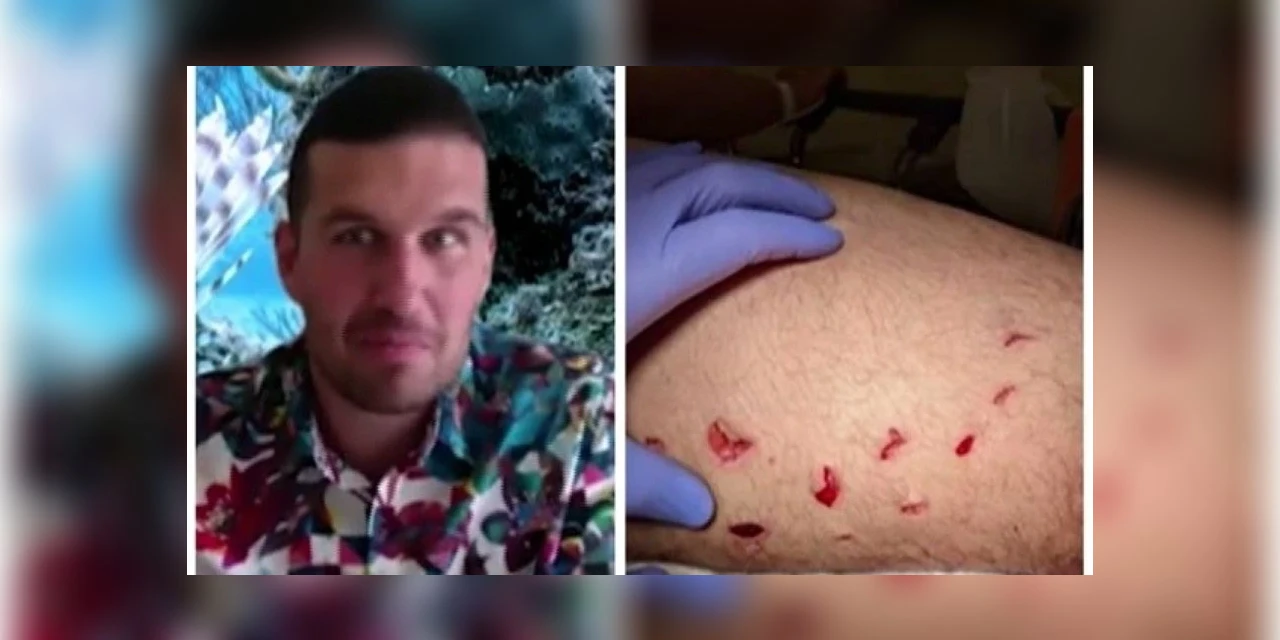 Homem sobrevive a ataque de tubarão-branco: "como uma mordida de mosquito"