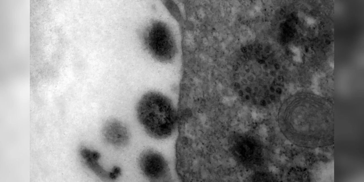 COVID-19: anticorpos podem durar até 12 meses após infecção