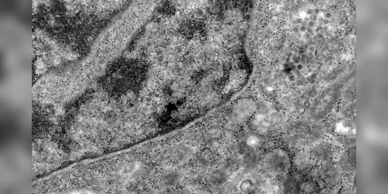 Inédito: Pesquisadores conseguem detectar coronavírus pela análise de retina