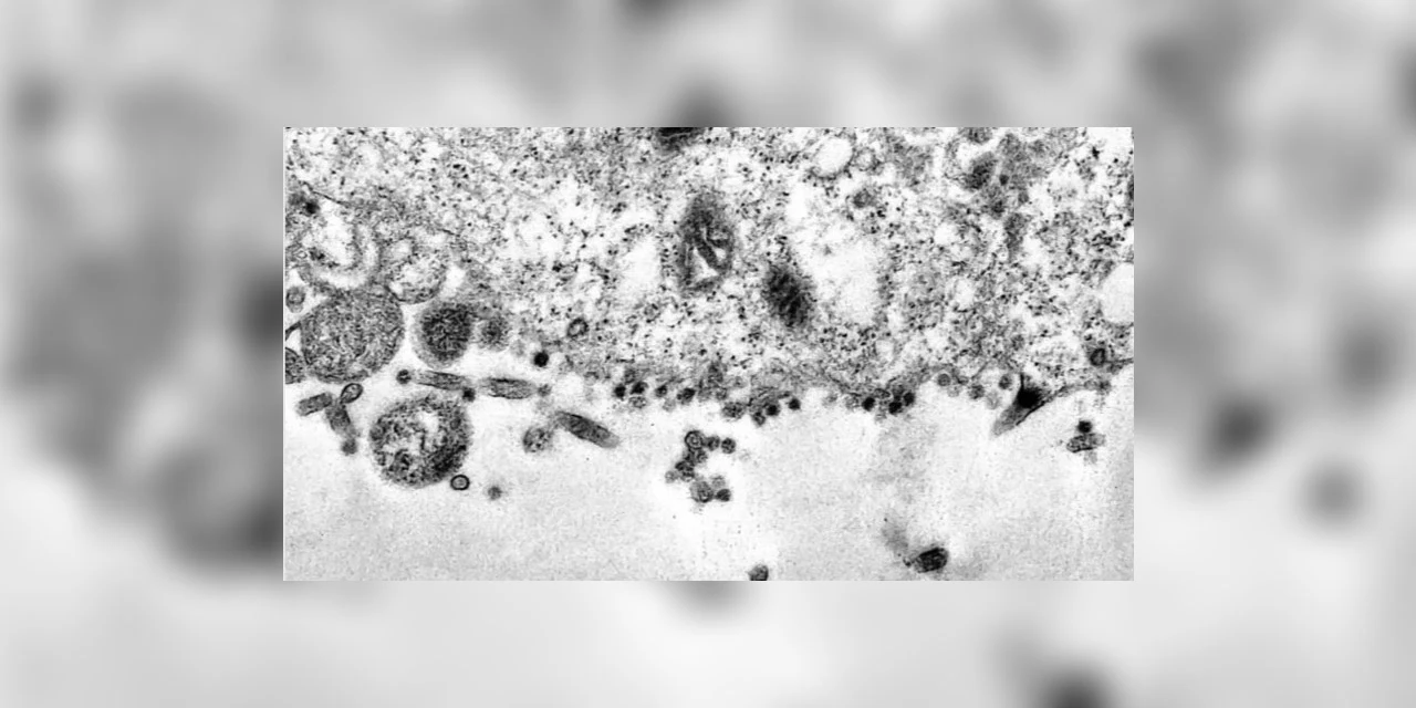 Pesquisadores brasileiros criam equipamento capaz de capturar coronavírus no ar