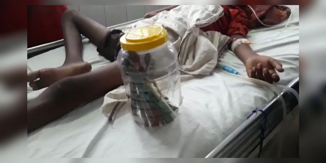 Menino engole 16 escovas de dentes e um prego para superar 'vício' de comer terra
