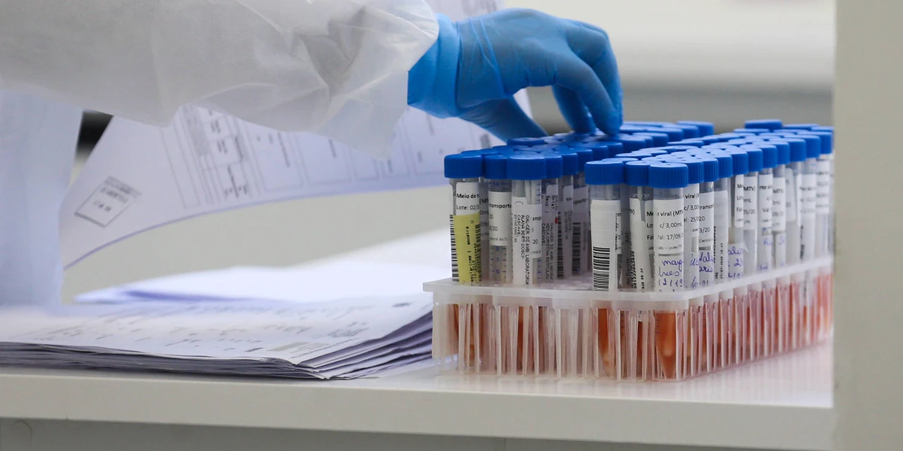Pesquisa da UTFPR mostra queda na percepção negativa da pandemia