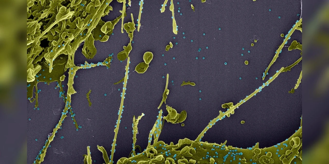 Anvisa recomenda restrições de voo diante de nova variante de COVID-19