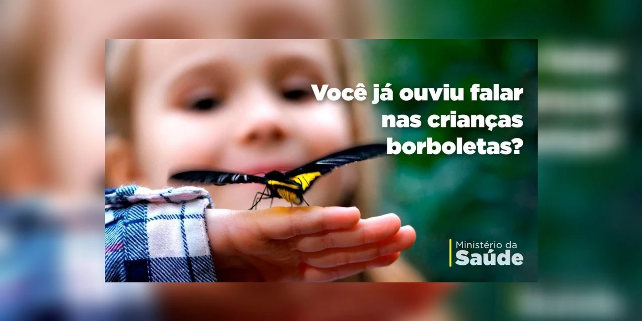 Projeto de lei visa conscientizar a sociedade sobre a Epidermólise Bolhosa