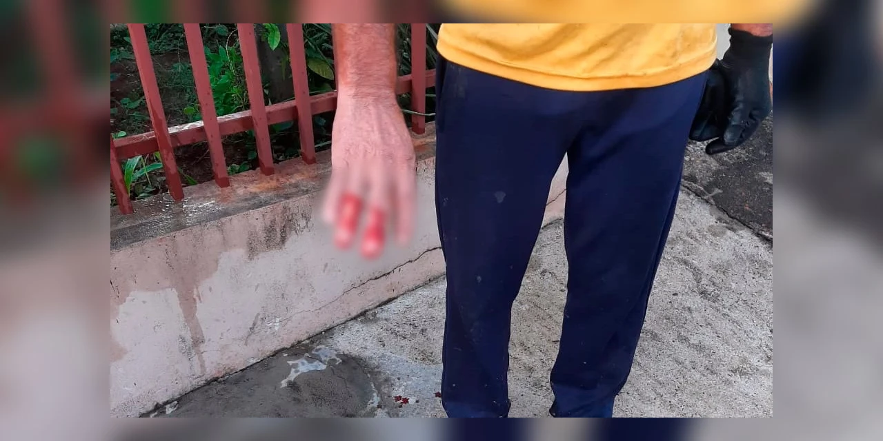 Coletor de Tibagi sofre acidente após armazenamento incorreto de lixo