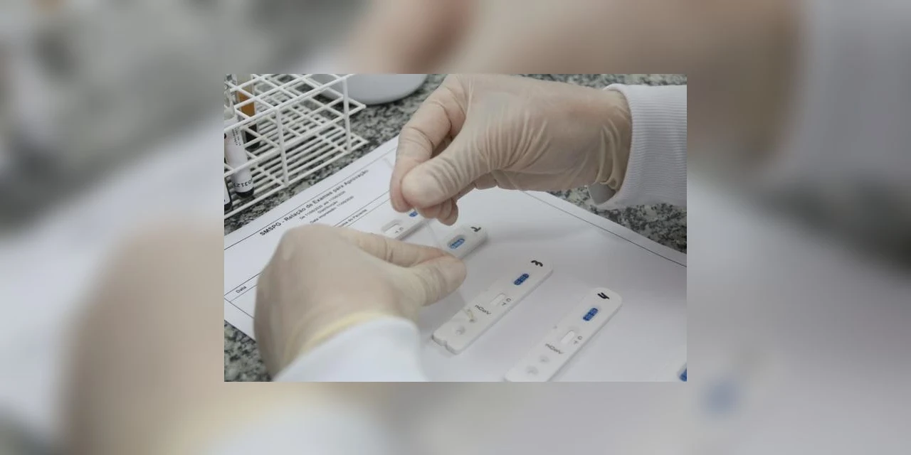 Covid-19: Ministério da Saúde envia à Anvisa nota defendendo liberação de autoteste