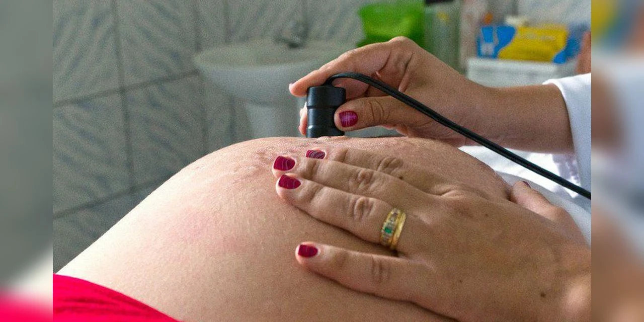 Auxílio Brasil: governo vai conceder benefício a gestantes