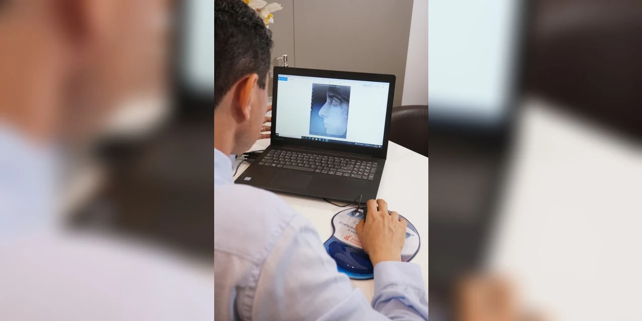 Rinoplastia é a segunda cirurgia plástica mais realizada por homens no Brasil