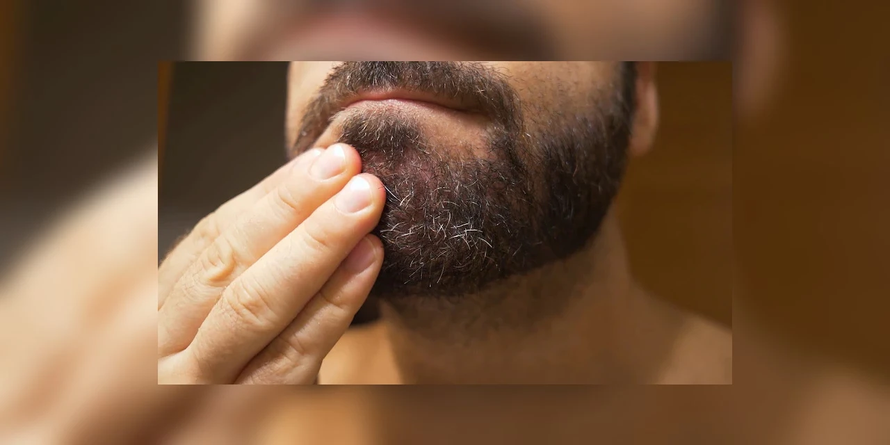 O que fazer para acabar com a coceira na barba?